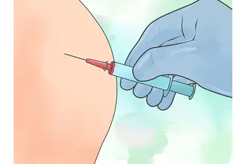 Siyatik İğnesi Kullanımı ve Faydaları Nelerdir?